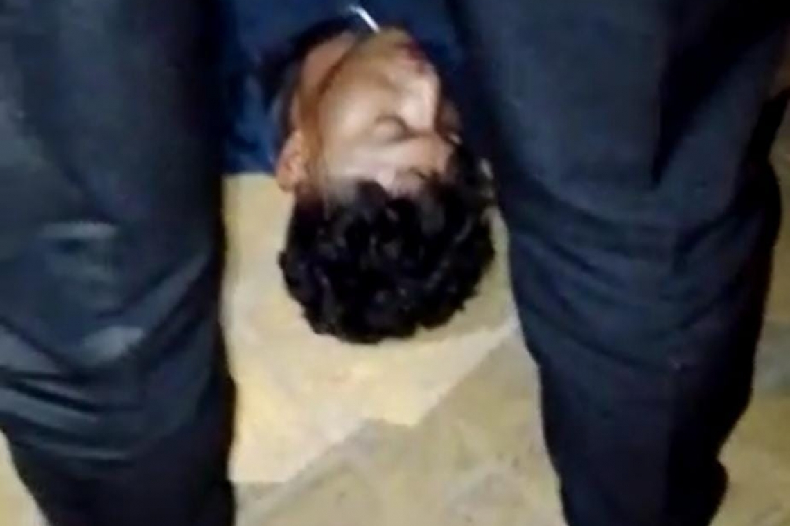Feroz perro pitbull atacó a un joven